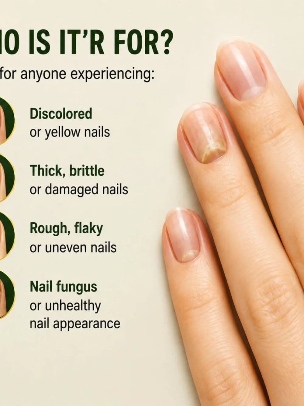 7 Days Nail Fungus Solution with Ginger Extract – 2.02 Fl Oz